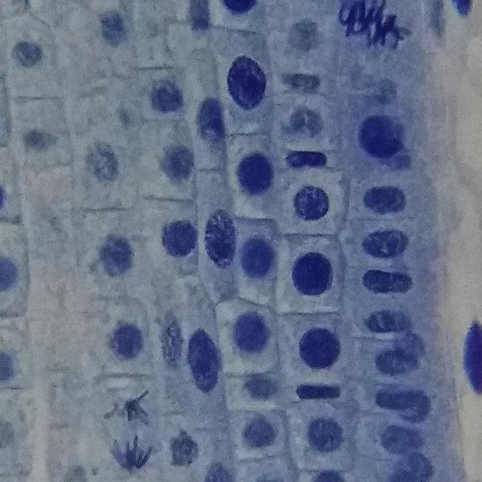 An Image No.1 Taken Using Bresser Erudit Basic Bino 40x-400x Microscope 