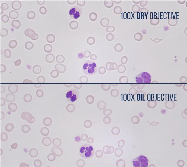 Image No.1 Comparison Using LW Scientific 100x Infinity Plan DRY Objective Over Oil Objective