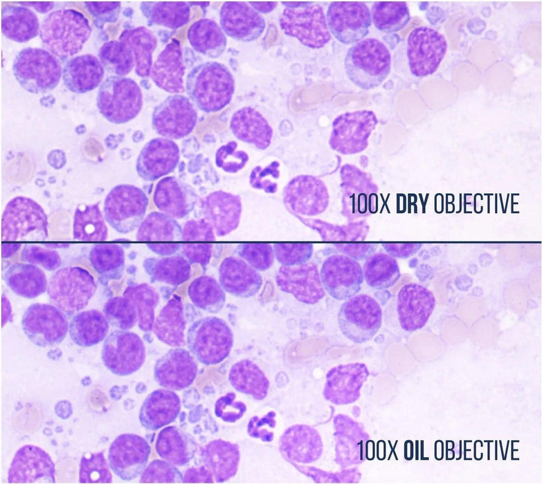 Image No.4 Comparison Using LW Scientific 100x Infinity Plan DRY Objective Over Oil Objective