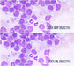 Image No.4 Comparison Using LW Scientific 100x Infinity Plan DRY Objective Over Oil Objective
